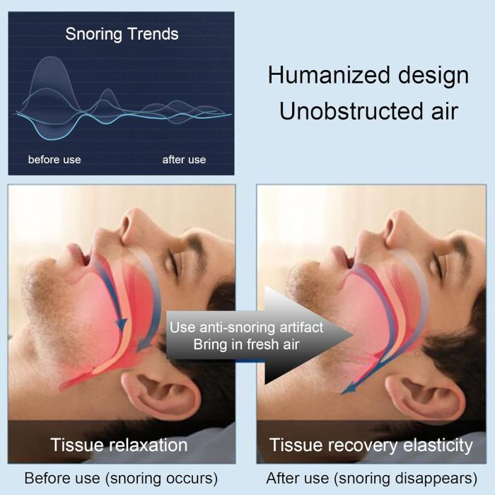 electronic_anti_snoring_effective_device2