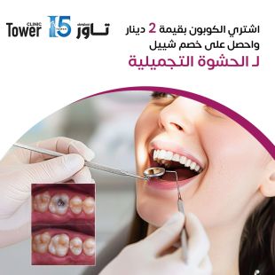 Pay 2KD on Sheeel Discount Tooth Colored Filling from Tower 15 Clinic - Floor 6