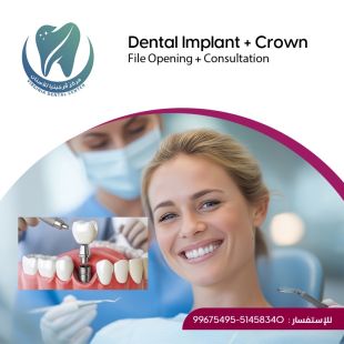 Get Your Sheeel Code and Get a Dental Implants at Virginia Dental Center - To Know Price of the Service Please Contact the Clinic