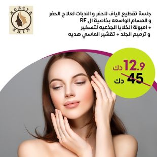 جلسة تقطيع الياف للحفر والندبات لعلاج الحفر لدى Acacia Skin