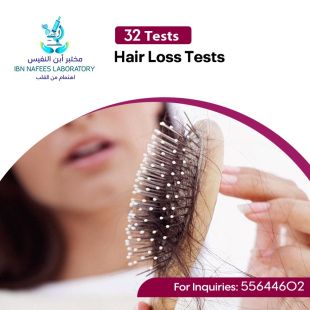 Get Your Sheeel Code and Enjoy Hair Loss Test at Ibn Nafees Lab - To Know Price of the Service Please Contact the Clinic