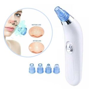 Blackhead Remover Pore Cleaning Suction Device