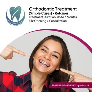 Get Your Sheeel Code and Get a Teeth Straightening (For simple cases) at Virginia Dental Center - To Know Price of the Service Please Contact the Clinic
