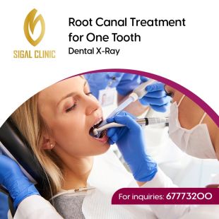 Get Your Sheeel Code and Enjoy a Root Canal Treatment for One Tooth with Dental X-Ray at Sigal Clinic - To Know Price of the Service Please Contact the Clinic