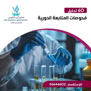 اطلب كود شيييل و احصل على خدمات مميزة لـ فحوصات المتابعة الدورية من مختبر ابن النفيس - لمعرفة قيمة الخدمة يرجى الاتصال على العيادة