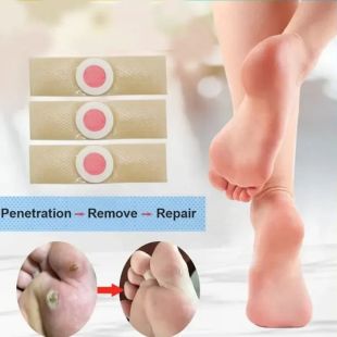 Wart Remover Pads 20 pcs