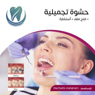 اطلب كود شيييل و احصل على خدمة مميزة لحشوة تجميلية من مركز فرجينيا لطب الأسنان - لمعرفة قيمة الخدمة يرجى الاتصال على العيادة