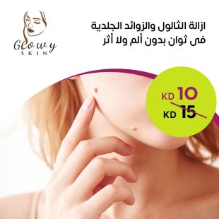 إزالة الثآليل والزوائد الجلدية في ثوانٍ بدون ألم ولا أثرمن Glowy Skin