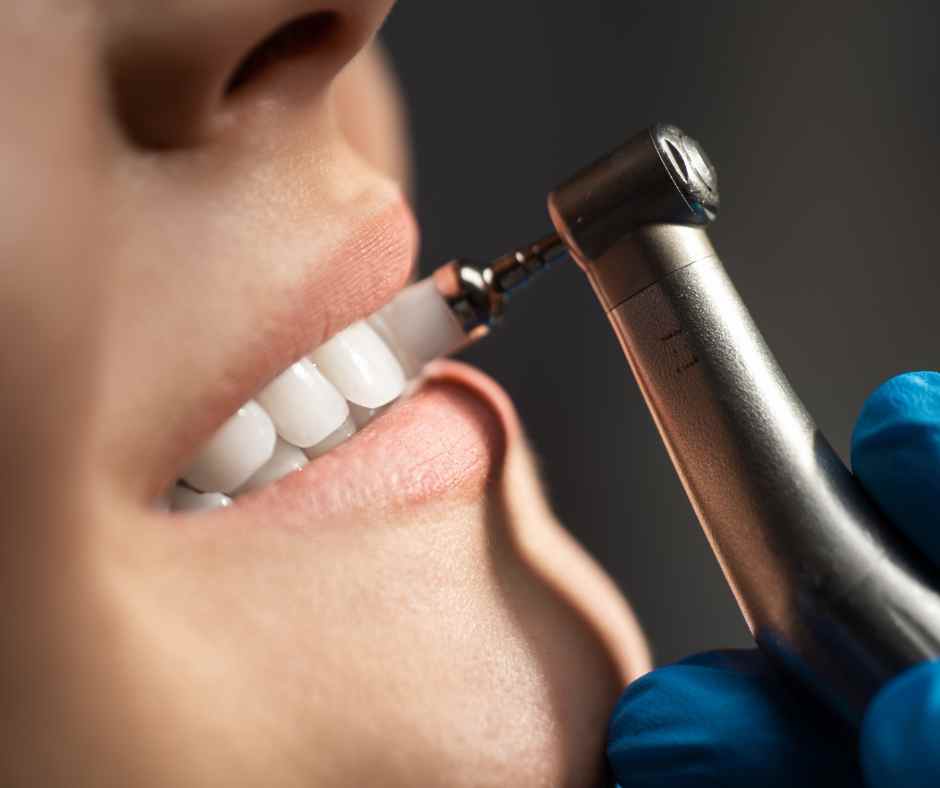 Dentist's tools used for professional cleaning and tartar removal