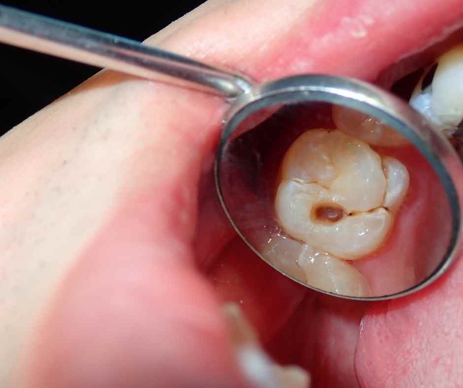A patient feeling tooth pain and needing specialized treatment